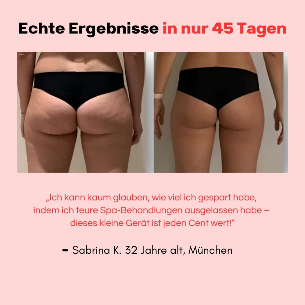 Hanna Sculpt – 3i1 Anti-Cellulit System