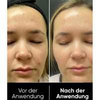 Hanna Reis Peel Shot Duo - Finere Porer & glattere hud på kun 3 minutter