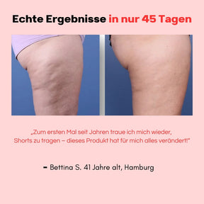 Hanna Sculpt – 3i1 Anti-Cellulit System