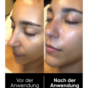 Hanna Rice Peel Shot Duo - Finer Pores & Smoother Skin in Just 3 Minutes