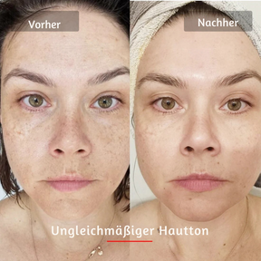 HANNA LED Face Mask PRO – Für glattere, straffere & sichtbar frischere Haut