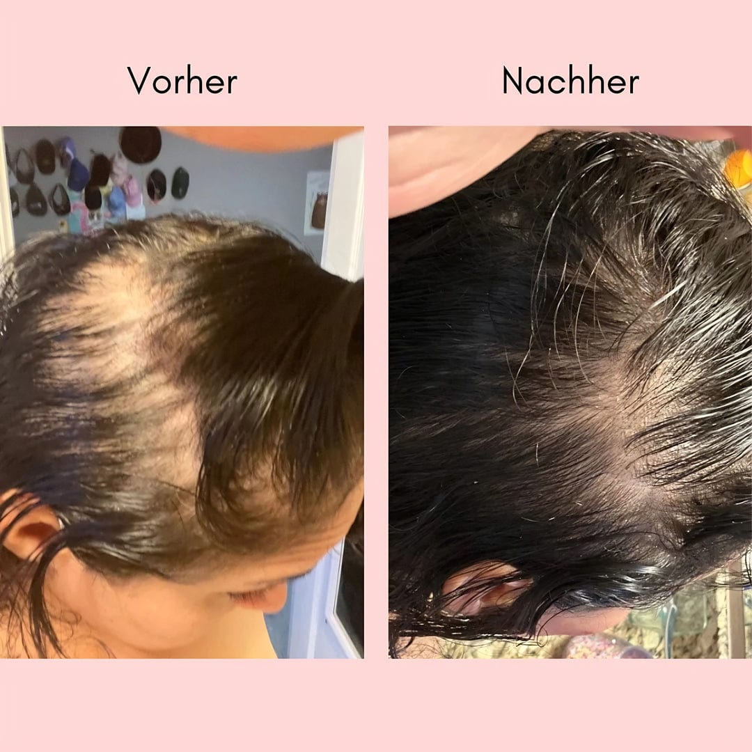 Hanna Elixir – Naturlig hårolie mod synligt hårtab og tyndere hår