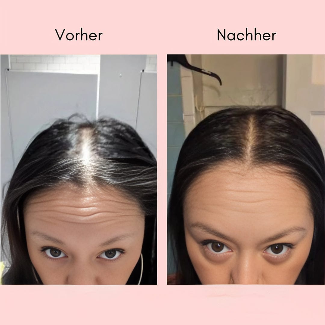 Hanna Elixir – Naturlig hårolie mod synligt hårtab og tyndere hår